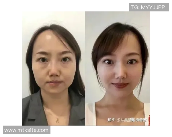 专访乒乓球女神陈丽揭秘她成功背后的心路历程与训练秘诀